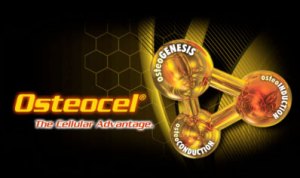 Osteocel bone regeneration
